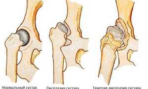 Дисплазия тазобедренных суставов у собак