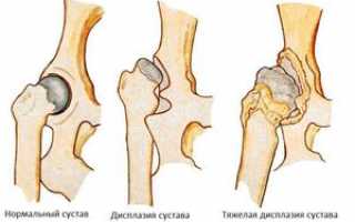 Дисплазия тазобедренных суставов у собак