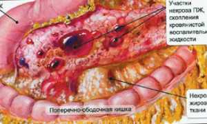Панкреатит у собак: причины, симптомы, лечение и профилактика